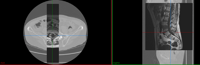 CT_MRI